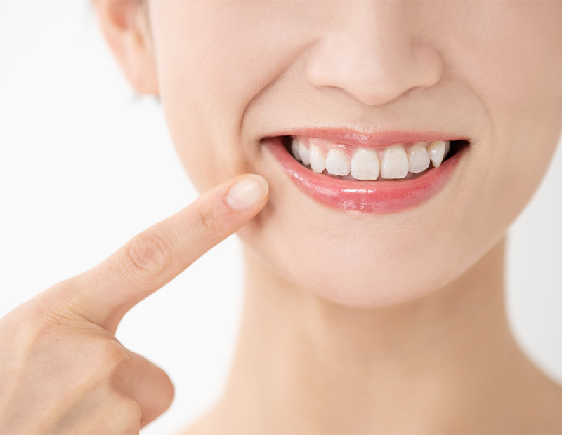 審美治療（さし歯）